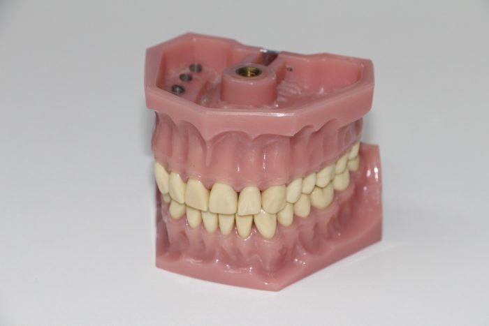 Dentier